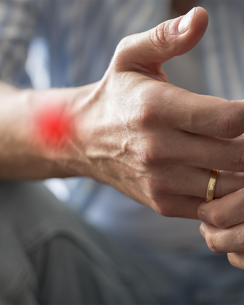 Síndrome del túnel carpiano y cómo prevenir lesiones en gamers